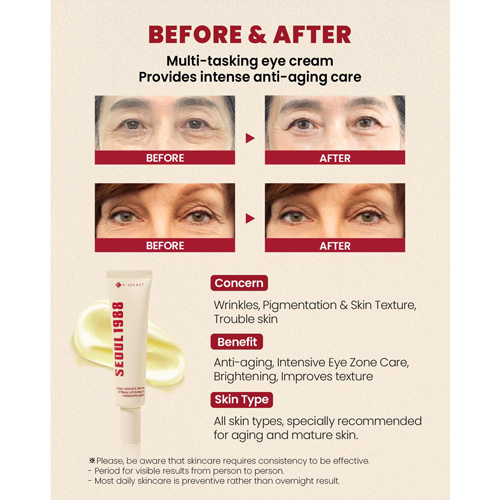 KSECRET - SEOUL 1988 Eye Cream : Retinal Liposome 4% + Fermented Bean