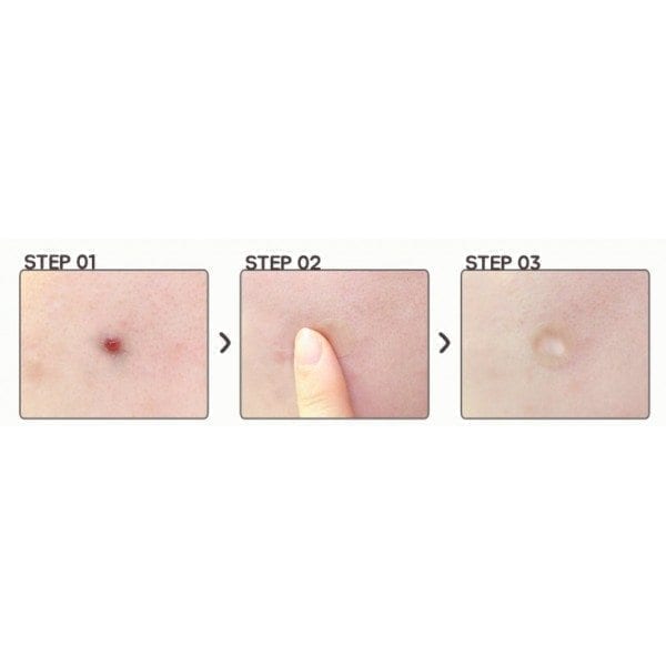 COSRX- Pimple Master Patch 24 pzas