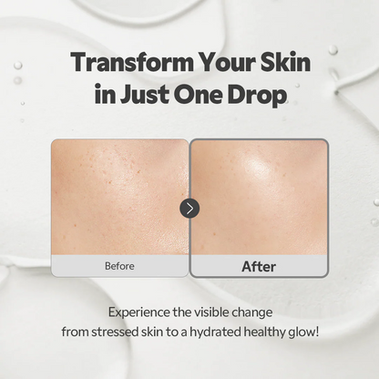 TIRTIR - SOS Serum Refreshing Skin