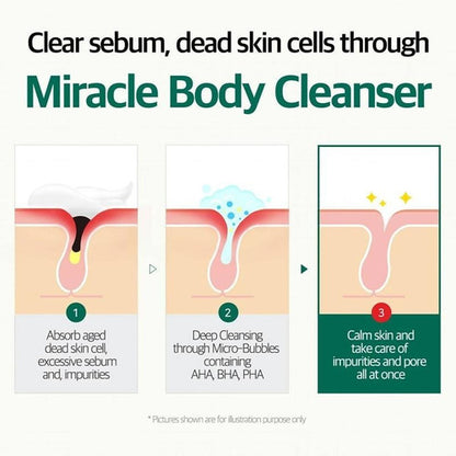 SOME BY MI - AHA, BHA, PHA 30 Days Miracle Acne Clear Body Cleanser